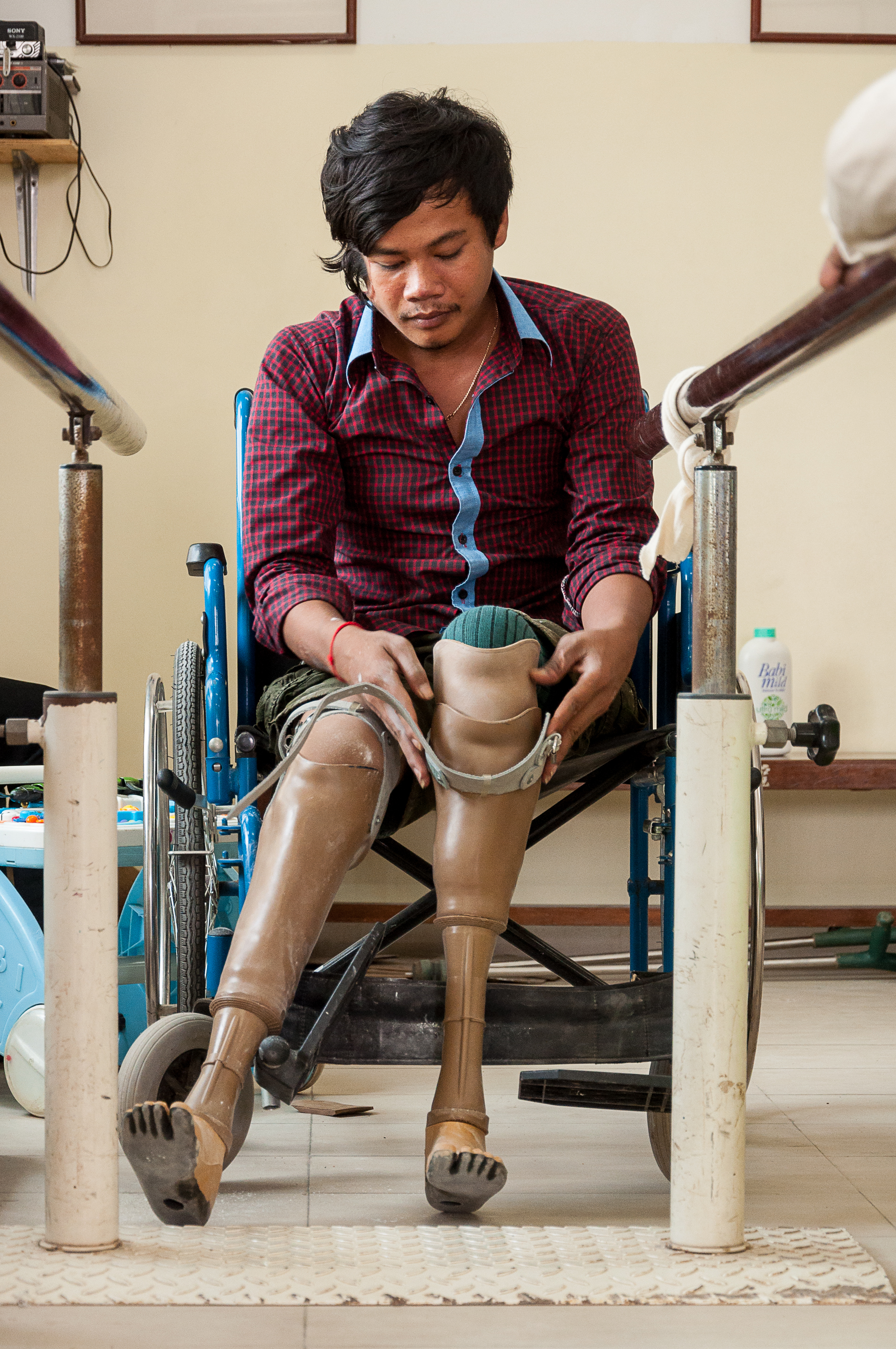 Man in wheelchair with prosthetic legs