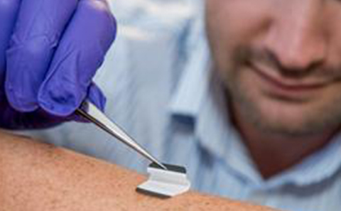 Doctor examining skin