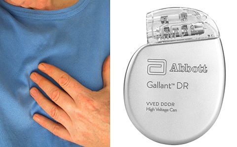 Cardiac arrest and defibrillator