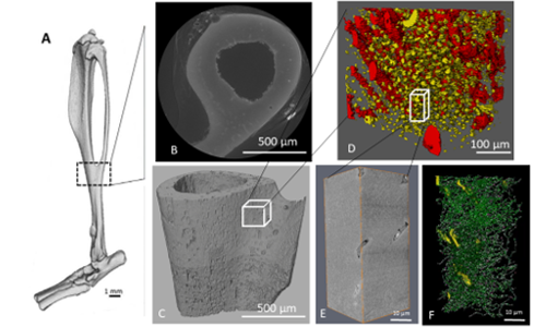 Correlative μCT and Electron Microscopy for 3D bone imaging