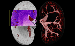 High contrast 3D kidney image