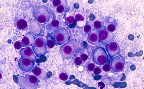 Myeloma cells