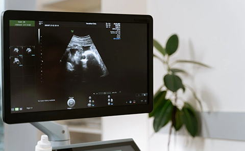 interconception period health