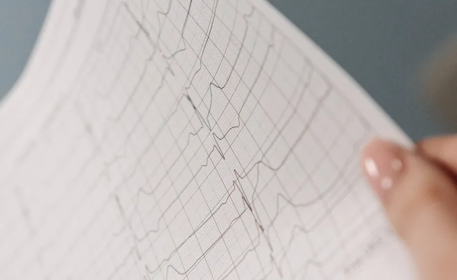 A person is holding an ECG or Electrocardiogram result on a piece of paper. We see their hand holding it up.