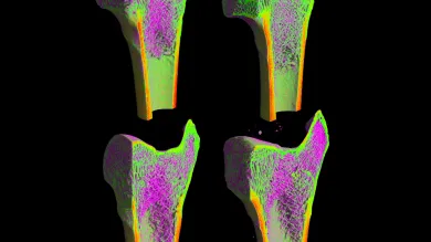 4 Stained femur cross sections