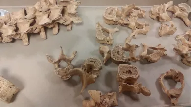 A collection of bones scattered across a table top