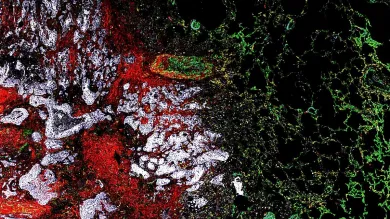 Microscopic image showing a pattern of green, red, white, and black areas respresenting the complex biological structures that make up a tumour microenvirionment