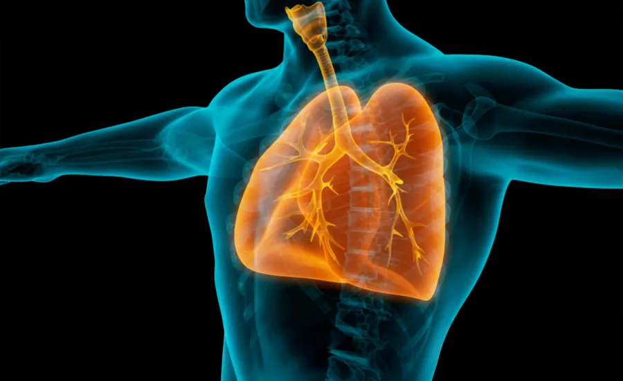 A medical illustration showing the upper body of a person with the lungs highlighted in orange. The trachea, bronchi and branching airways are visible inside the ribcage.