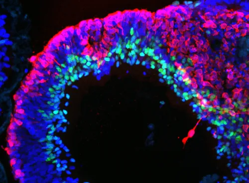 a human stem cell derived retinal organoid stained with antibodies for RECOVERIN (red, =photoreceptors) and AP2 (green, = amacrine cells). The lamination of the tissue and position of the cells is similar to a human retina. 