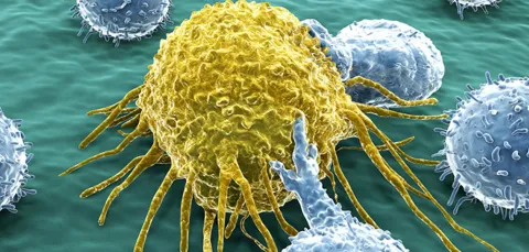 An artist's impression of the human immune system attacking a cancer cell.
