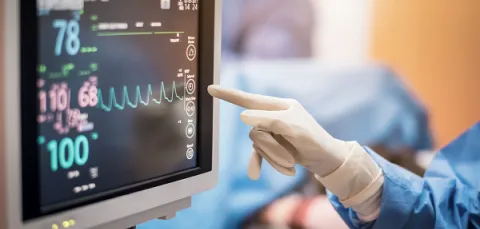 A surgeon monitoring a screen.