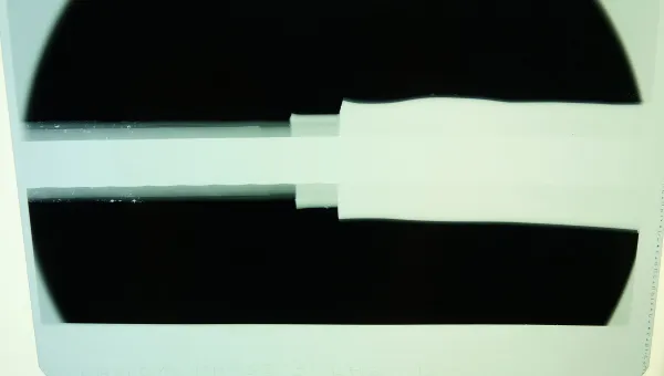 Forensic X-ray