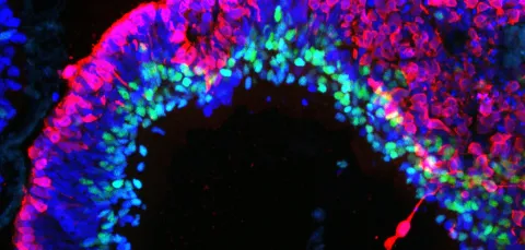 a human stem cell derived retinal organoid stained with antibodies for RECOVERIN (red, =photoreceptors) and AP2 (green, = amacrine cells). The lamination of the tissue and position of the cells is similar to a human retina. 