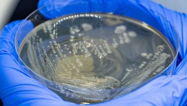 2 gloved hands holding a petri dish with bacteia growing 