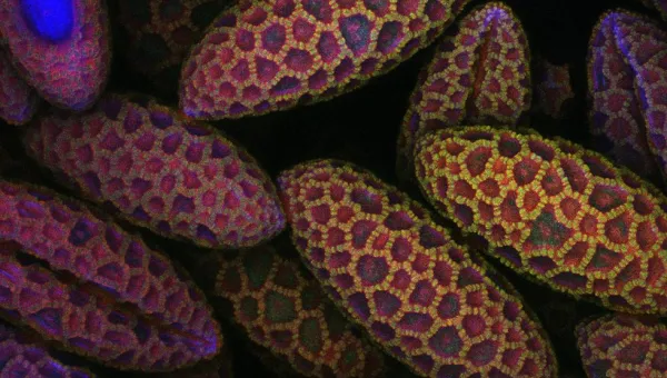 Close-up of lily pollen in a mosaic pattern, predominantly in red, yellow, and purple colors, with one distinctly bright blue entity.
