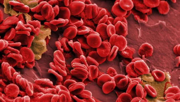 Close-up view of red blood cells on a syringe needle, interspersed with a cluster of white blood cells or platelets