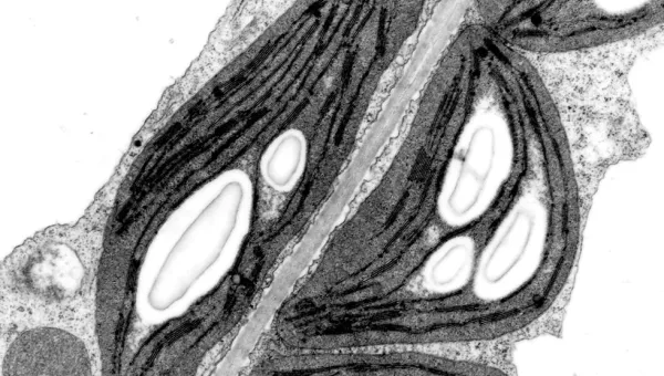 Monochrome electron micrograph showing detailed striated muscle fibers with visible mitochondria, set against a granular cytoplasmic background