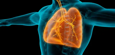 A medical illustration showing the upper body of a person with the lungs highlighted in orange. The trachea, bronchi and branching airways are visible inside the ribcage.