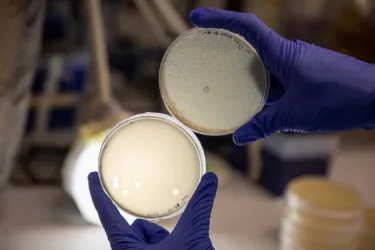 Two petri dishes held up by gloved hands, showing bacterial lysis by phages.