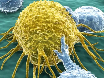An artist's impression of the human immune system attacking a cancer cell.