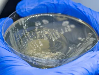 2 gloved hands holding a petri dish with bacteia growing 