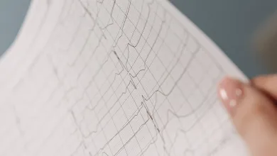 A person is holding an ECG or Electrocardiogram result on a piece of paper. We see their hand holding it up.