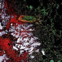 Microscopic image showing a pattern of green, red, white, and black areas respresenting the complex biological structures that make up a tumour microenvirionment